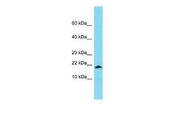 XAGE1A Rabbit anti-Human, Polyclonal, Novus Biologicals:Antibodies:Primary